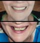 Slider image (9) Dr. Aleksandar Kovacevic - Dental Clinic in Croatia